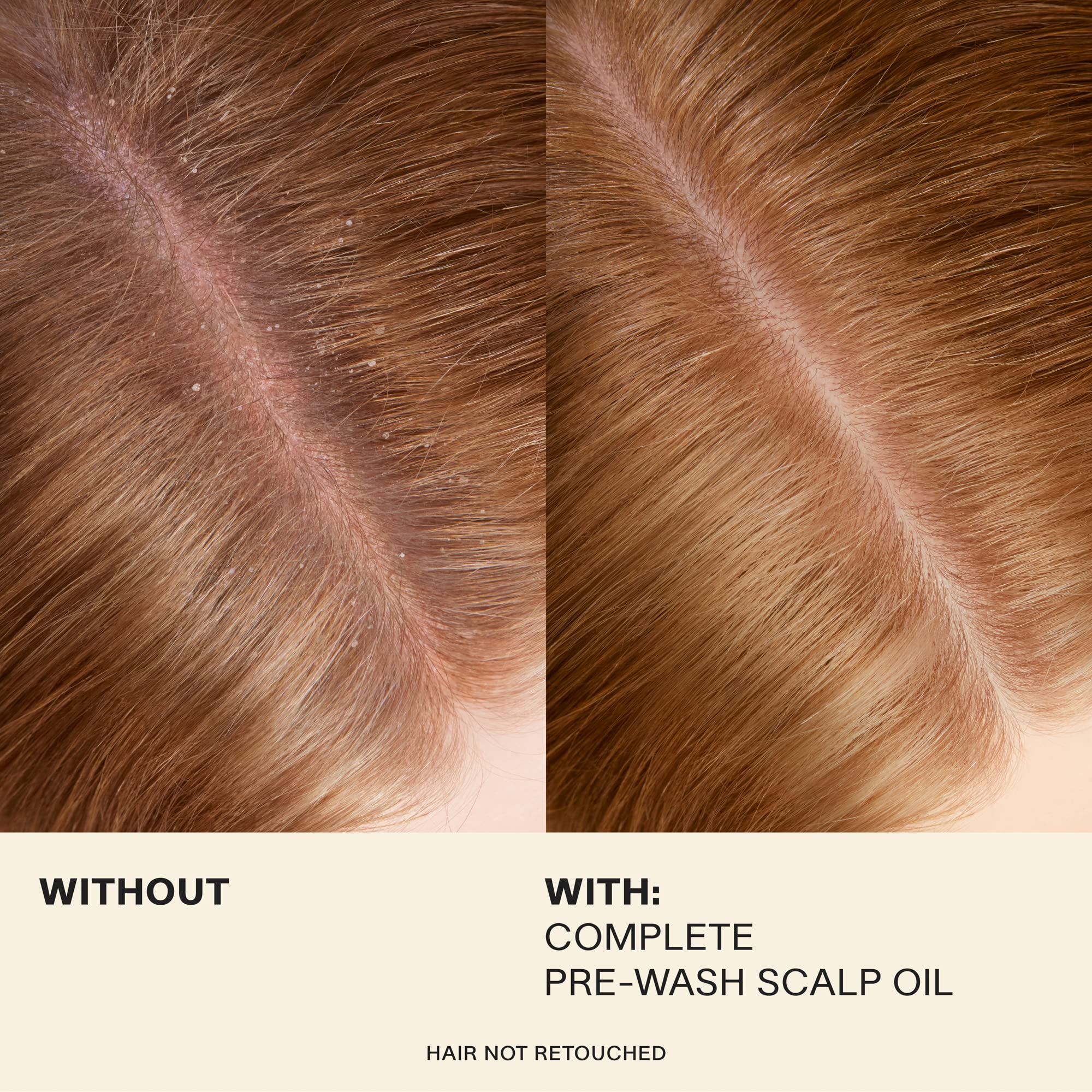 JVN Rosemary extract visual highlights natural ingredient supporting scalp circulation.