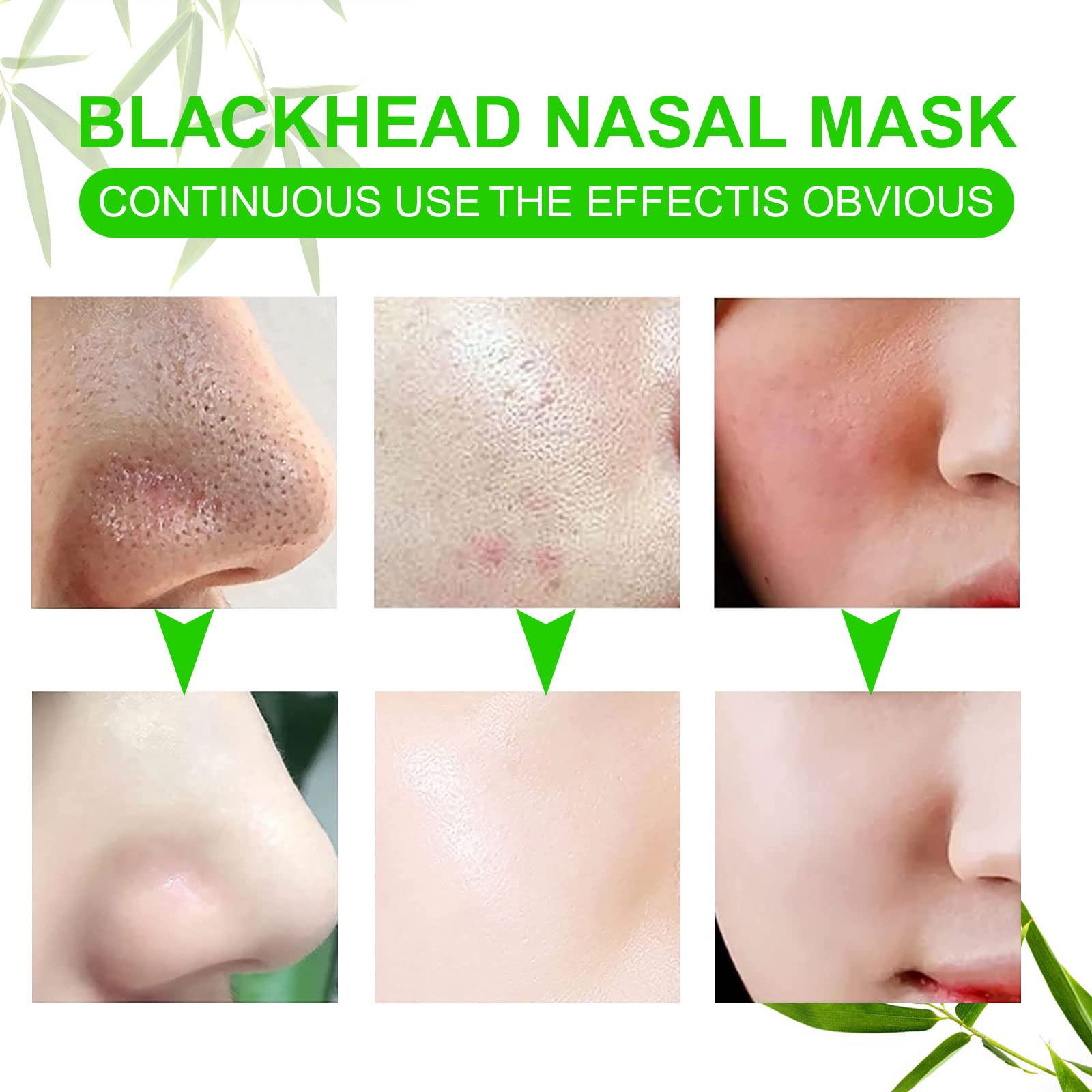 JWBVCTCR gentle strips minimize irritation while cleansing pores.