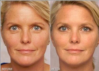 K6 Skin Care Retinol Gel 0.1, envase cómodo para uso diario.