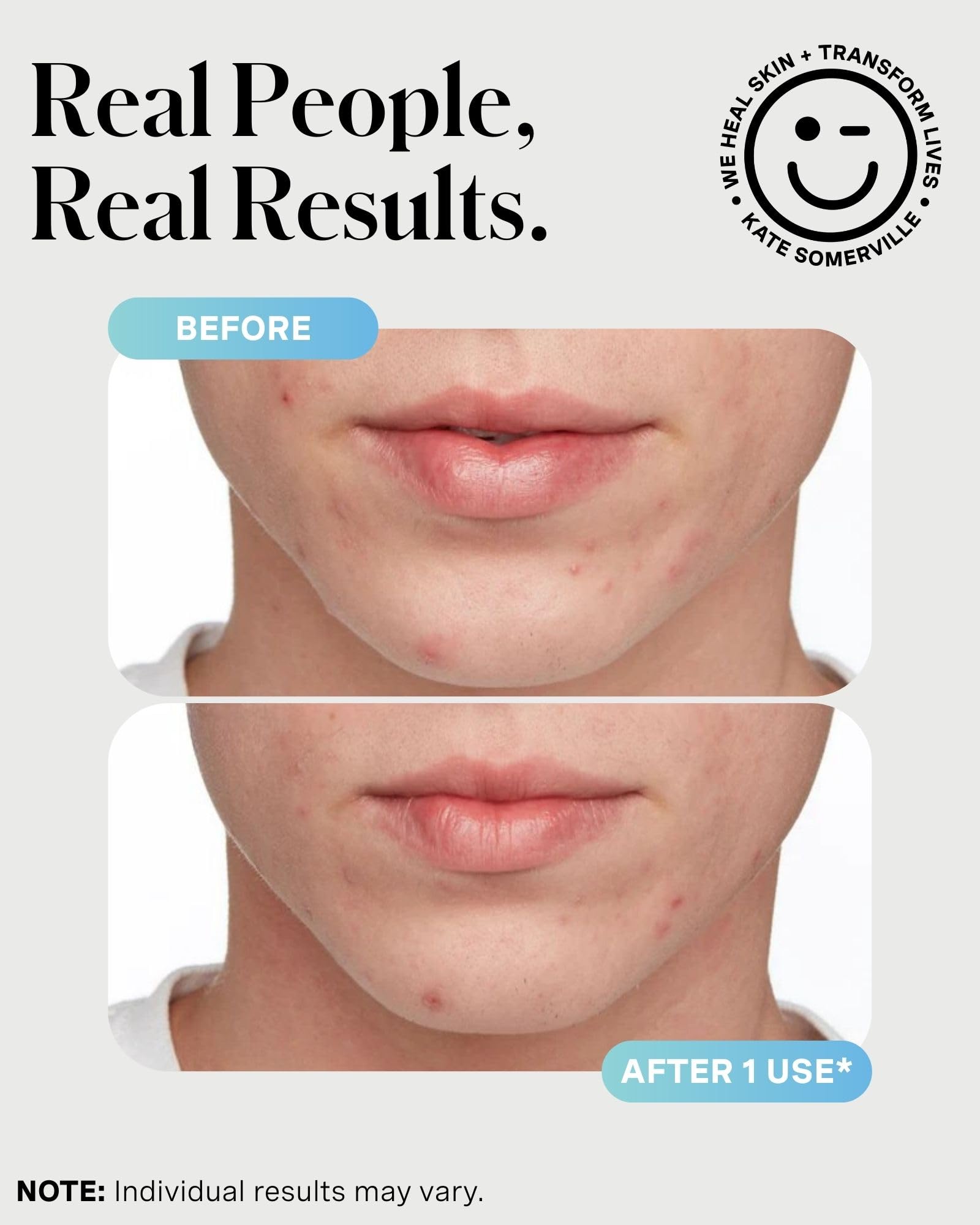 Illustration suggesting before and after potential results with EradiKate.