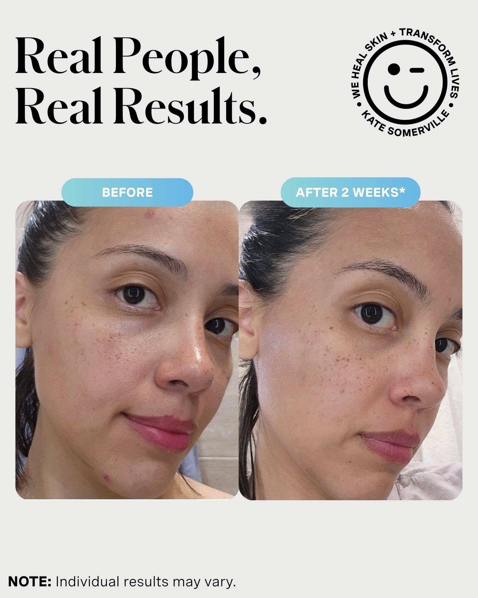 Clinic-to-home formulation of Kate Somerville EradiKate for professional care at home.