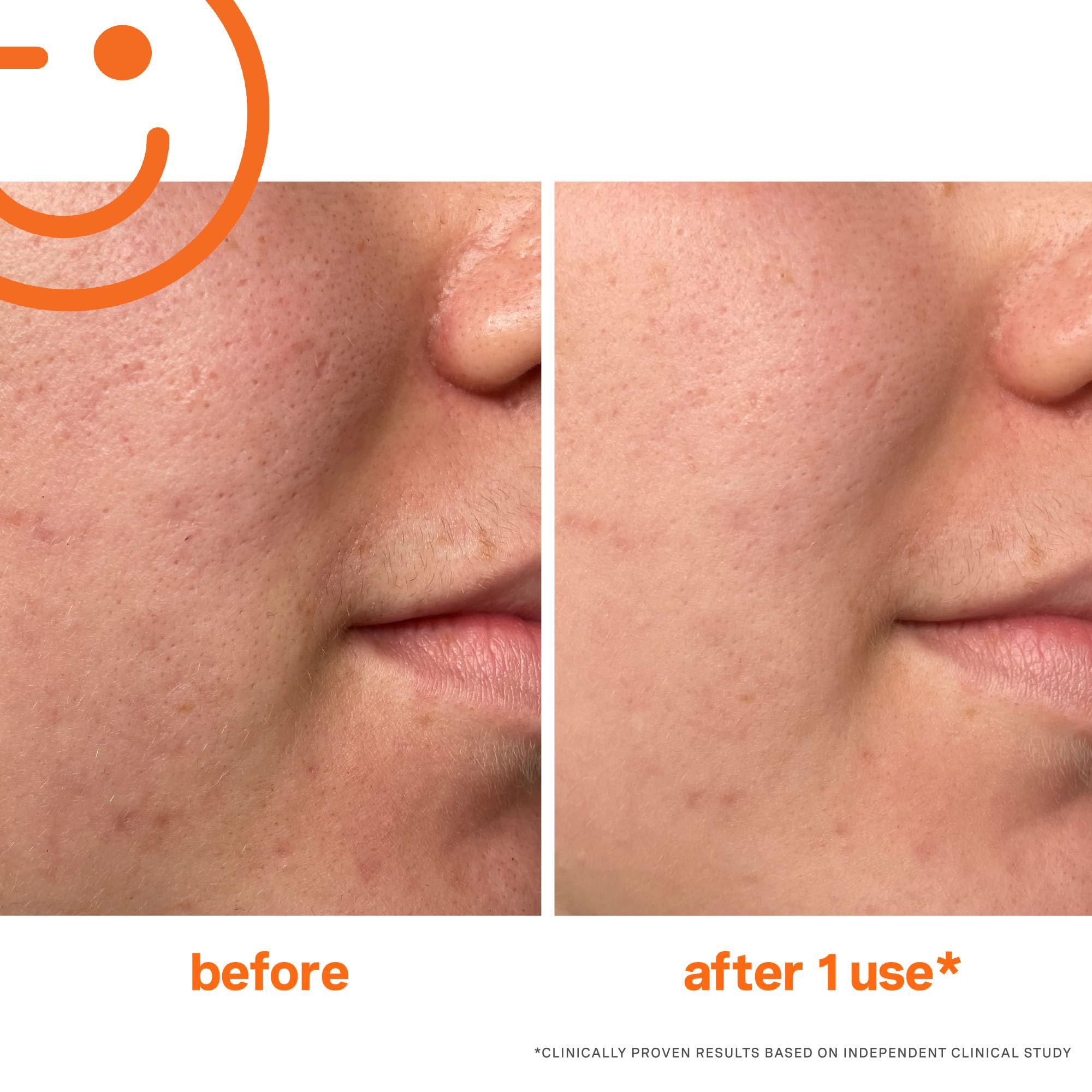 Kate Somerville Exfolikate ingredients reveal acids and enzymes for skin refinement