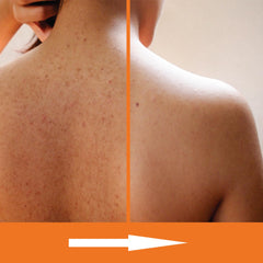 KERAPIL Ducha exfoliante sin fragancia, opción adecuada para piel sensible.