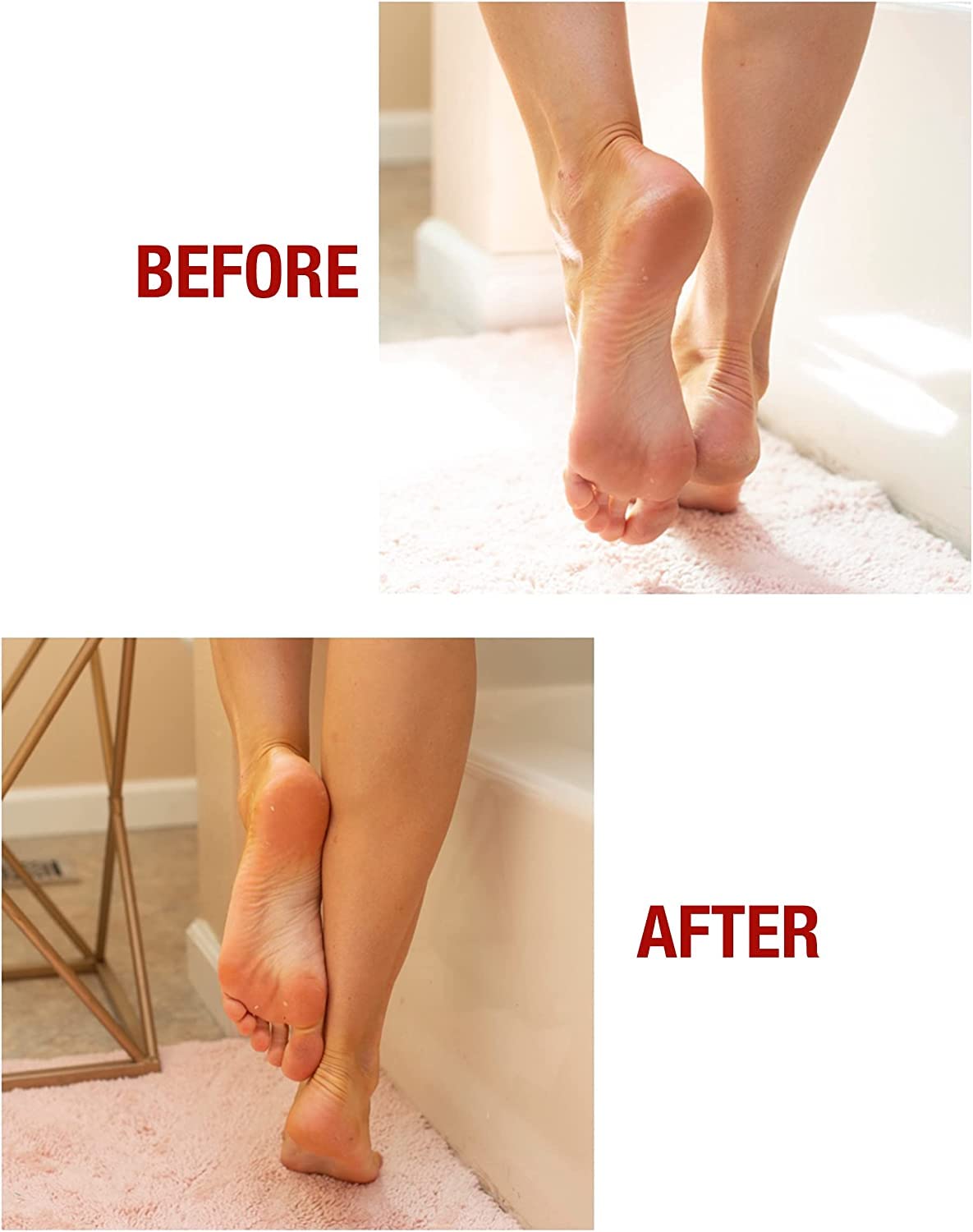 Kerasal gel socks worn at night provide comfortable heel care.
