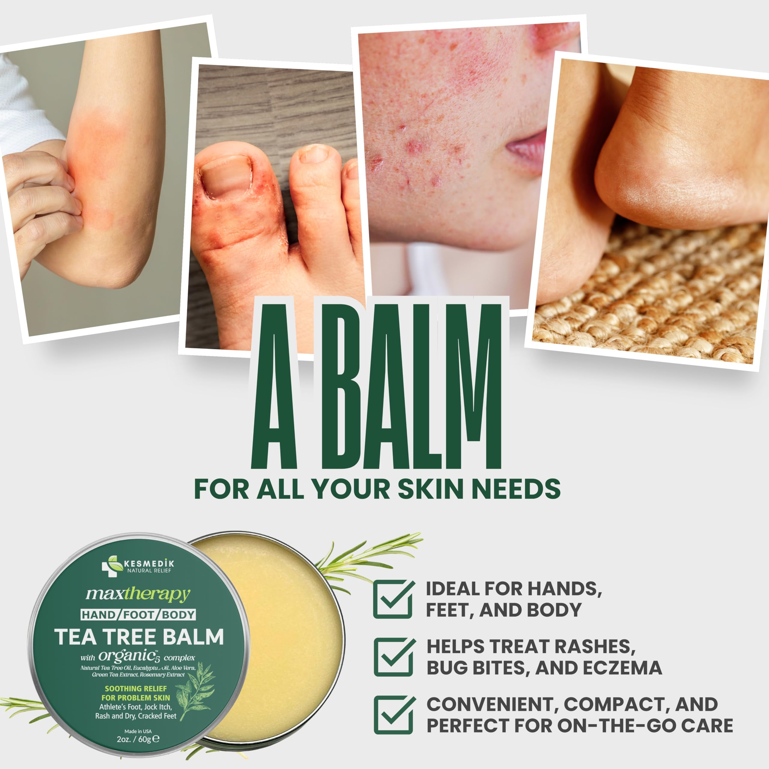 KESMEDIK Tea Tree Oil Balm applied on skin suggests itch relief.