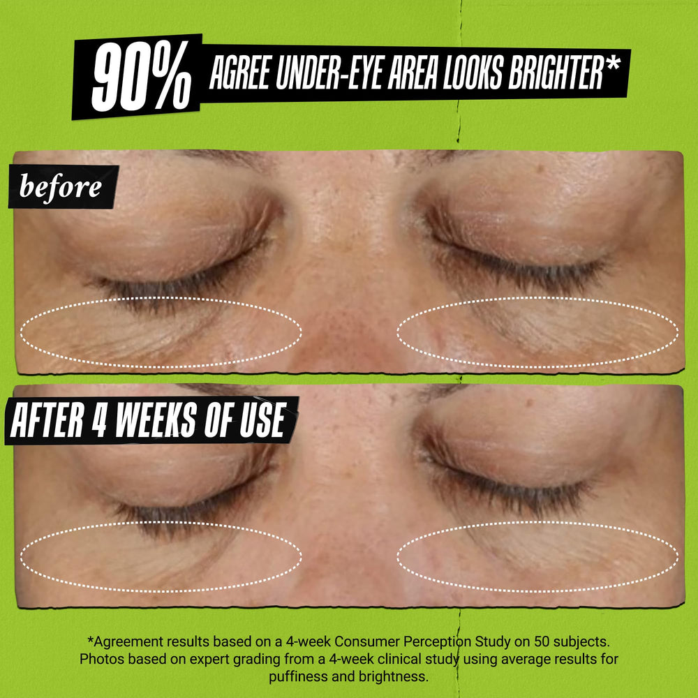 Kiehl's Avocado Eye Treatment being applied for smooth absorption around the eye area.