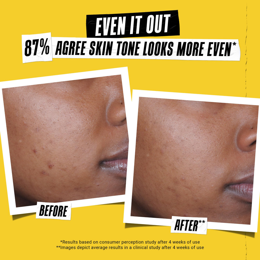 Kiehl's Better Screen UV Serum con péptidos de colágeno para un cuidado ligero.