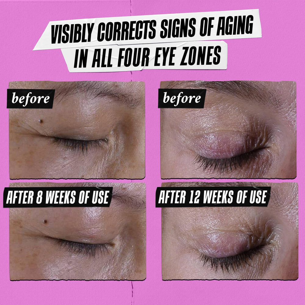 Kiehl's brow bone lift focus showing subtle contour improvement.