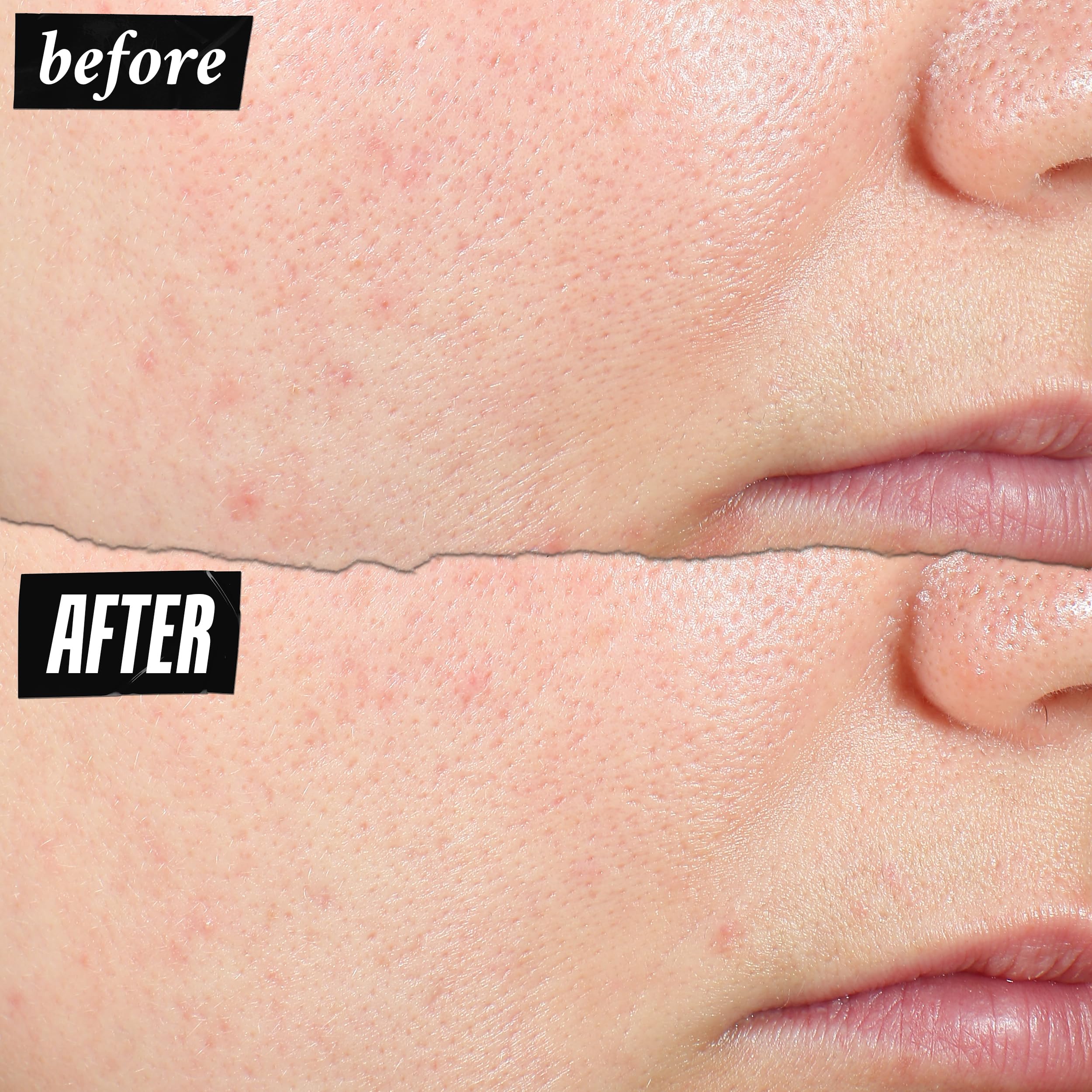 Kiehl's Expertly Clear Niacinamide graphic highlights tone-evening potential for clearer skin.