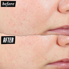 Kiehl's Expertly Clear Niacinamide graphic highlights tone-evening potential for clearer skin.