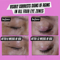 Kiehl's Eye Cream under-eye-de-puff reduces puffiness for a brighter appearance.