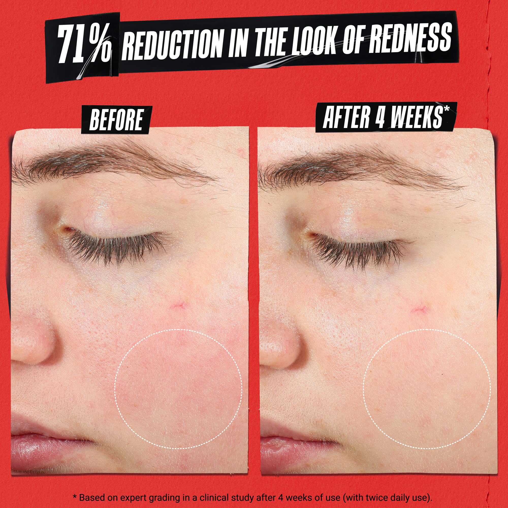 Kiehl's Recovery Barrier Cream texture appears gel-like and absorbs quickly