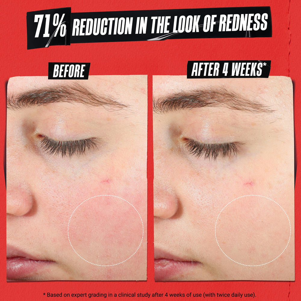 Kiehl's Recovery Barrier Cream texture appears gel-like and absorbs quickly