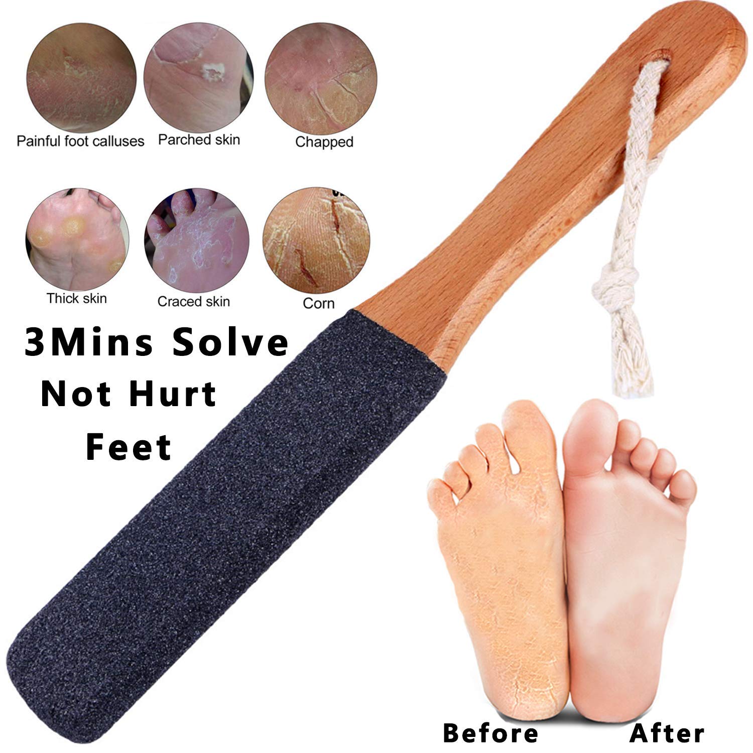 Natural corundum stone on Kinepi remover delivers comfortable exfoliation.