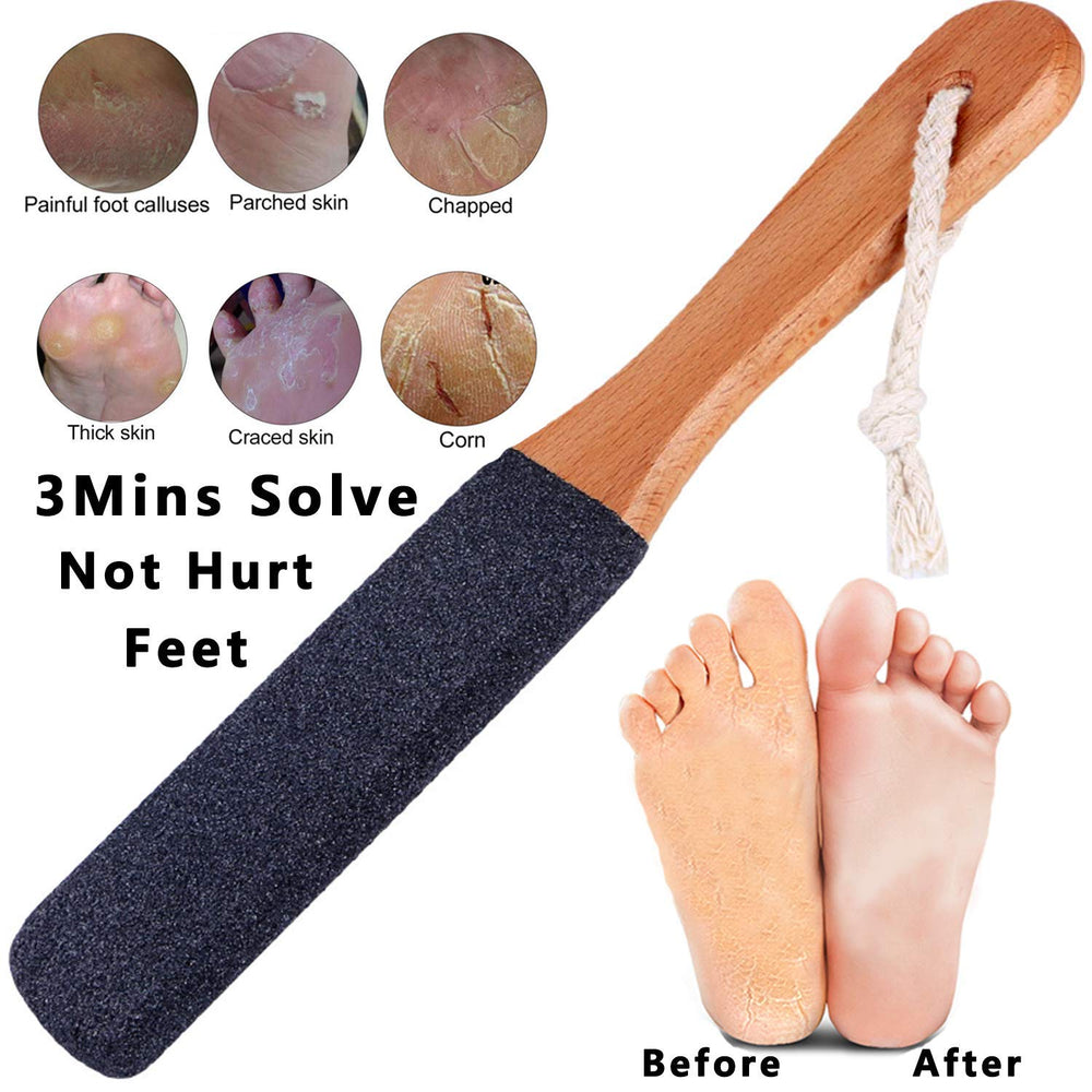 Natural corundum stone on Kinepi remover delivers comfortable exfoliation.