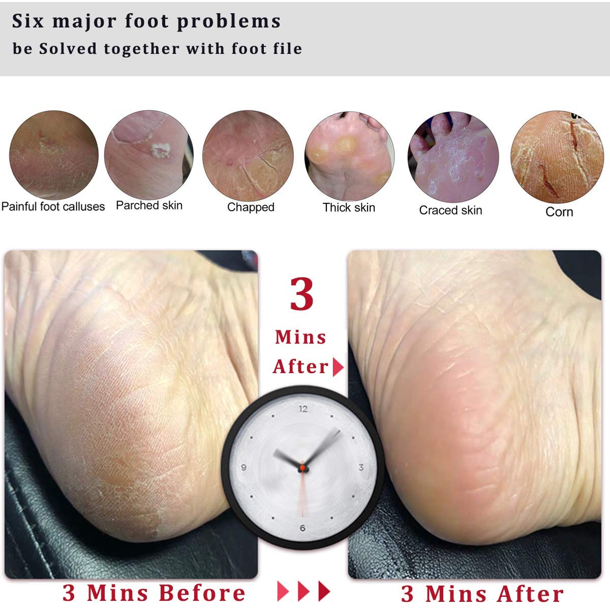 Dual-sided foot scrubber supports gentle and deep exfoliation.