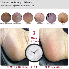 Dual-sided foot scrubber supports gentle and deep exfoliation.