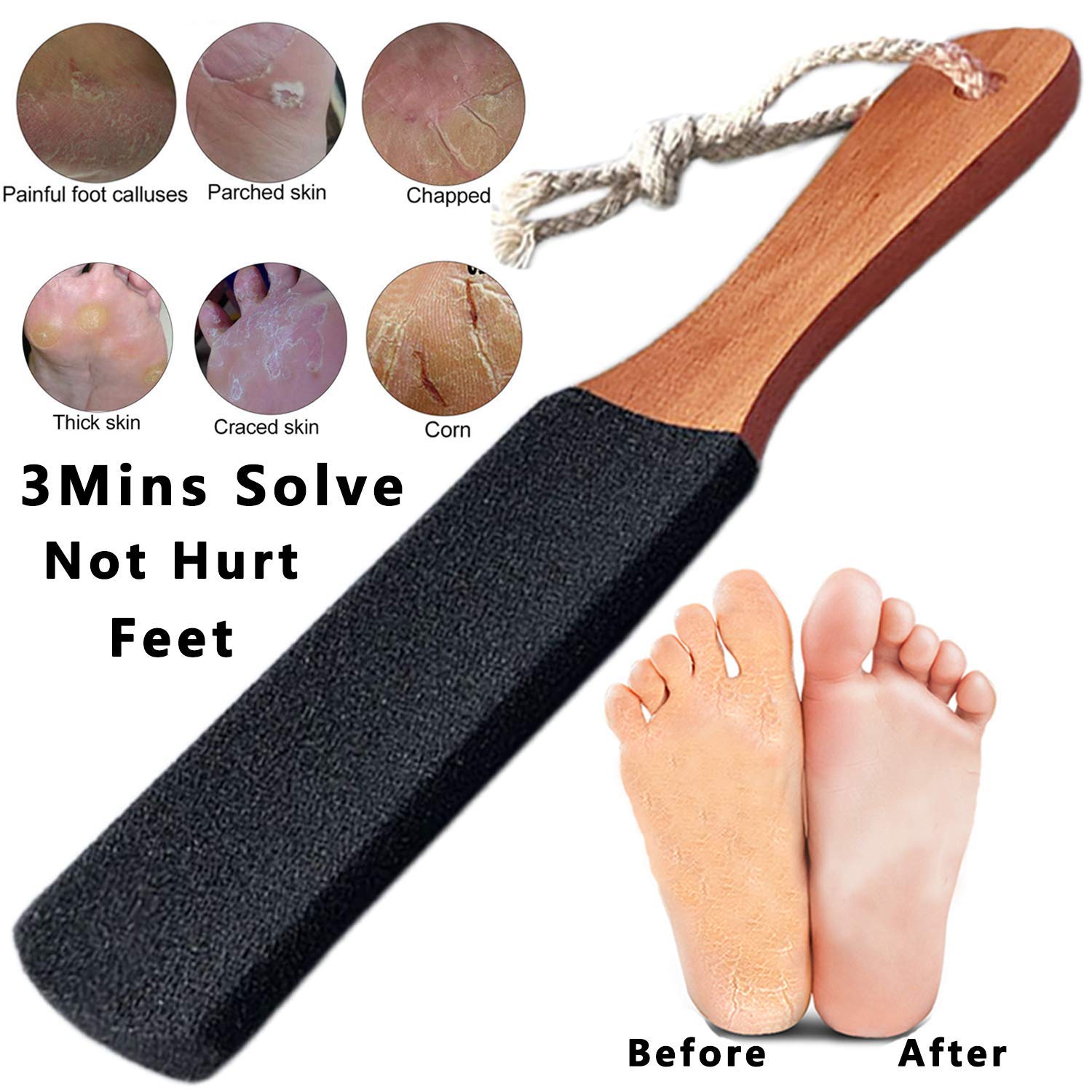 Kinepi Foot Scrubber dual-sided stone for targeted exfoliation