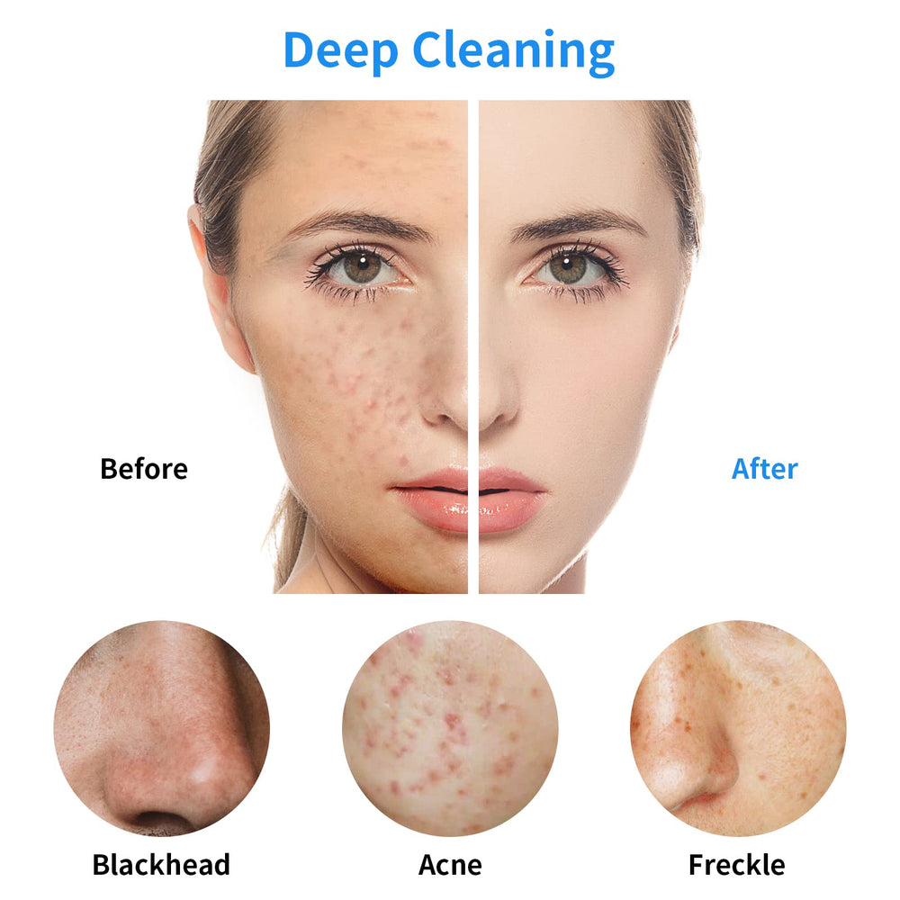 Kirecoo face cleansing brush closeup for deep pore cleansing