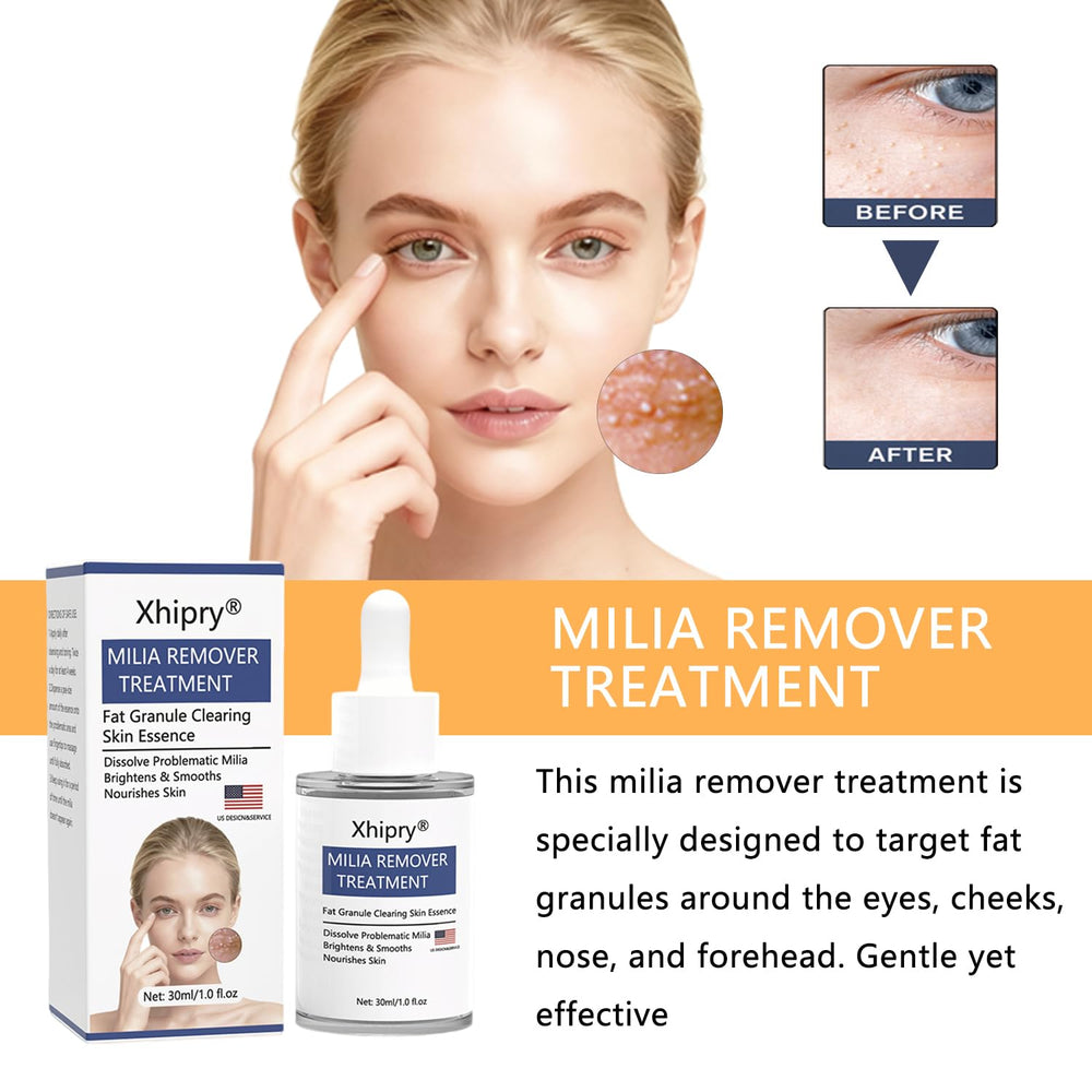 Kisinly Milia Remover, gotero, absorción rápida sin grasa