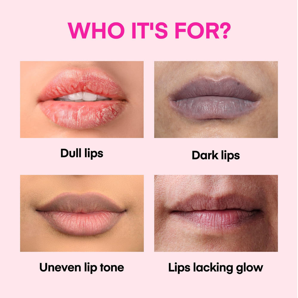 KissBea Aclarado de Labios, aceites nutritivos para labios sensibles y secos.