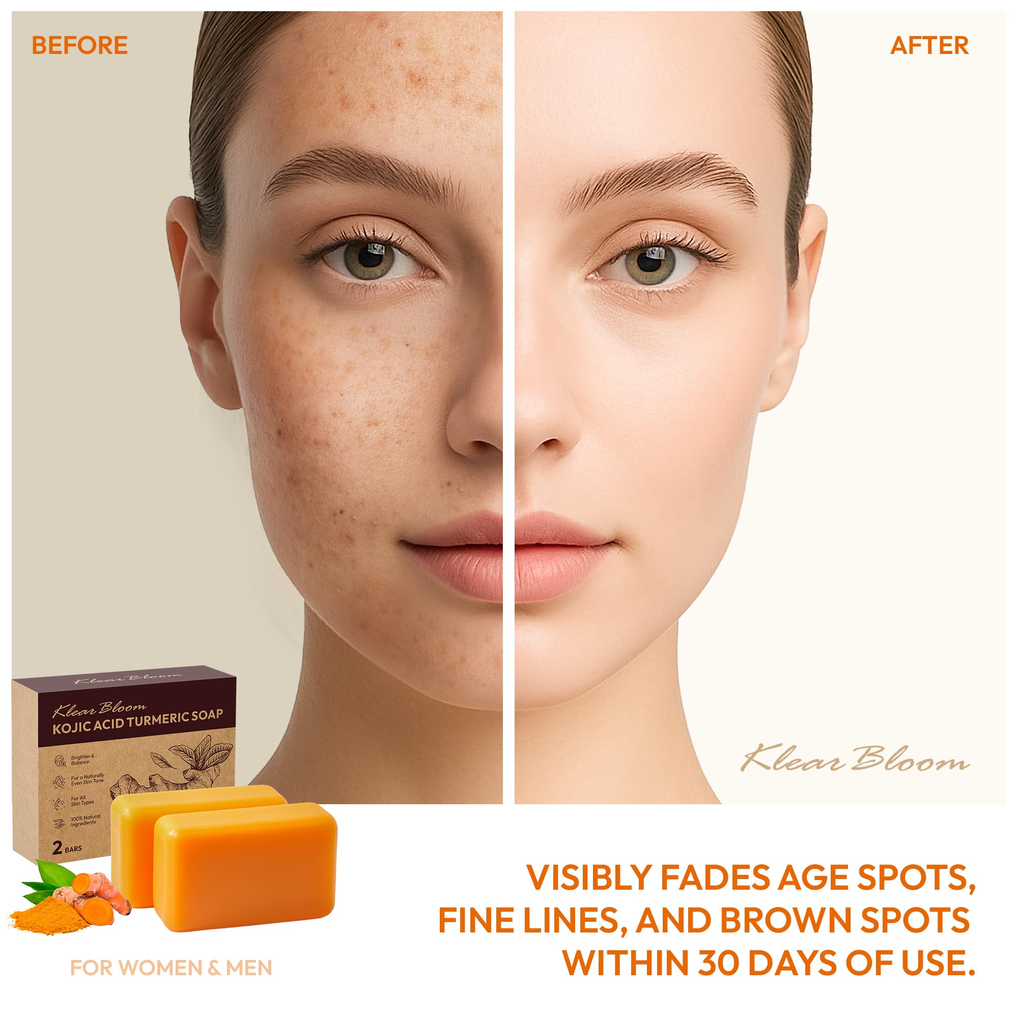 KlearBloom Kojic Turmeric Soap bar close-up emphasizing deep hydration for smoother skin.