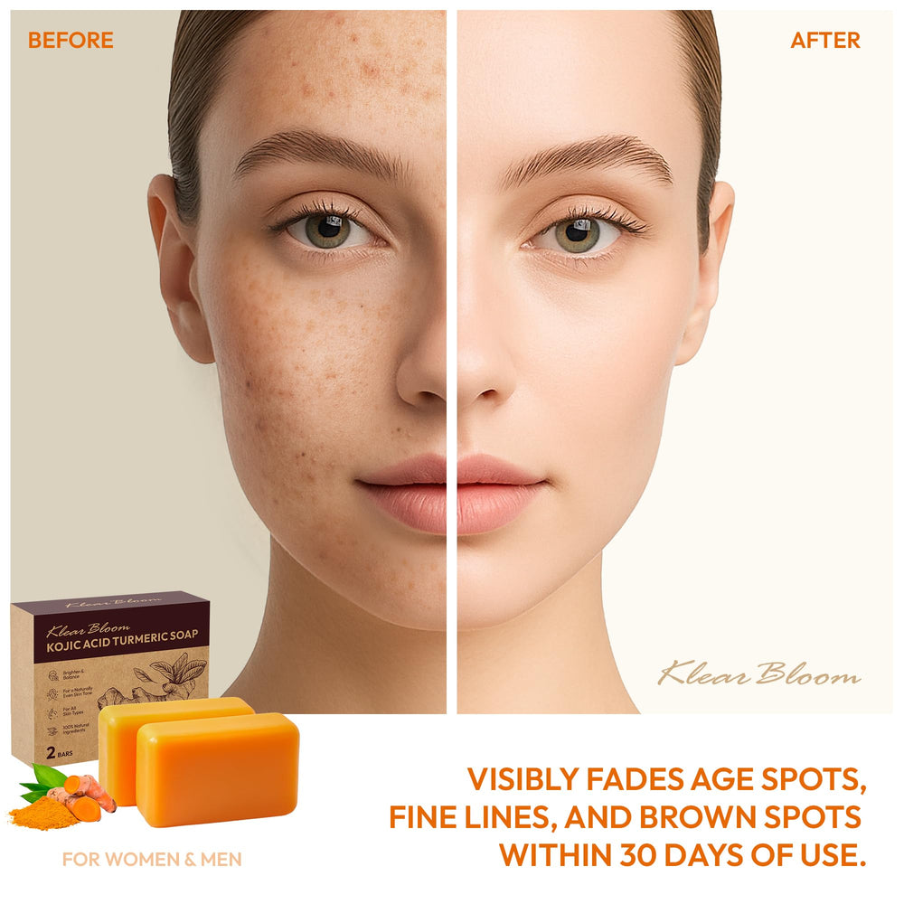 KlearBloom Kojic Turmeric Soap bar close-up emphasizing deep hydration for smoother skin.