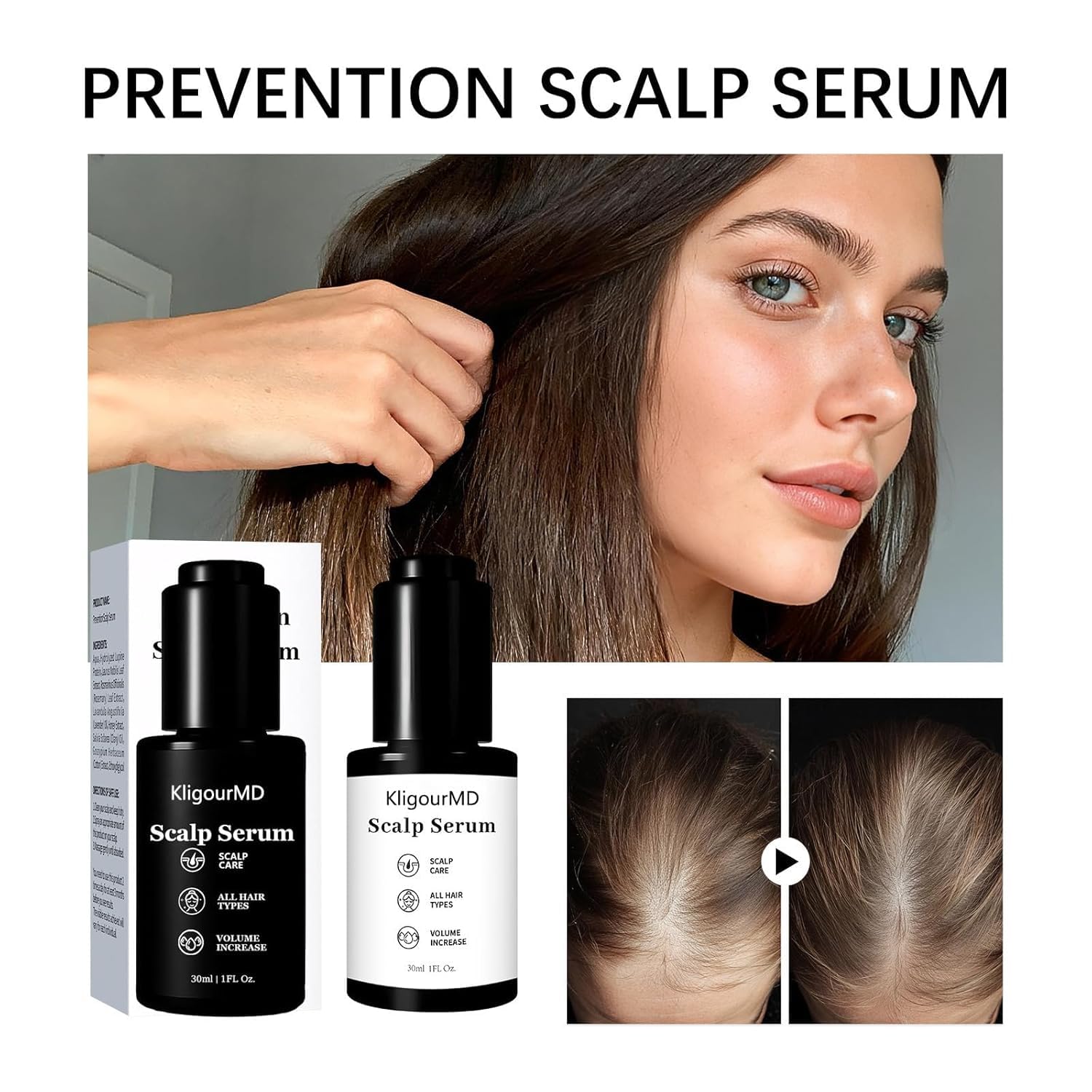 KligourMD eight-extract blend image—botanical ingredients supporting scalp wellness.