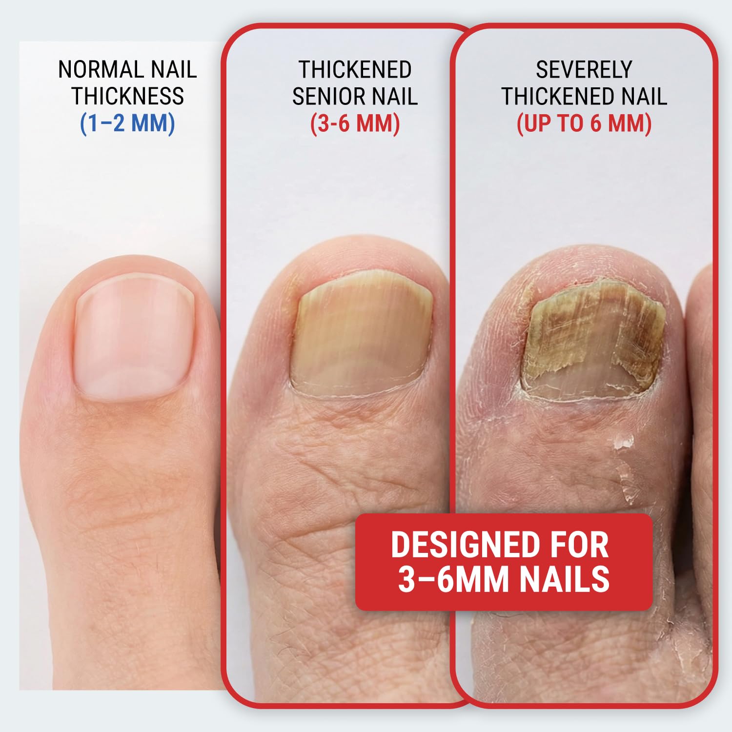 KLIPP Toenail Clippers curved blades deliver smooth cuts for curved nails.