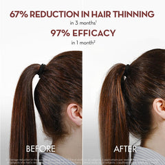 Klorane serum quinine bottle closeup emphasizes plant-based ingredients for thinning hair.