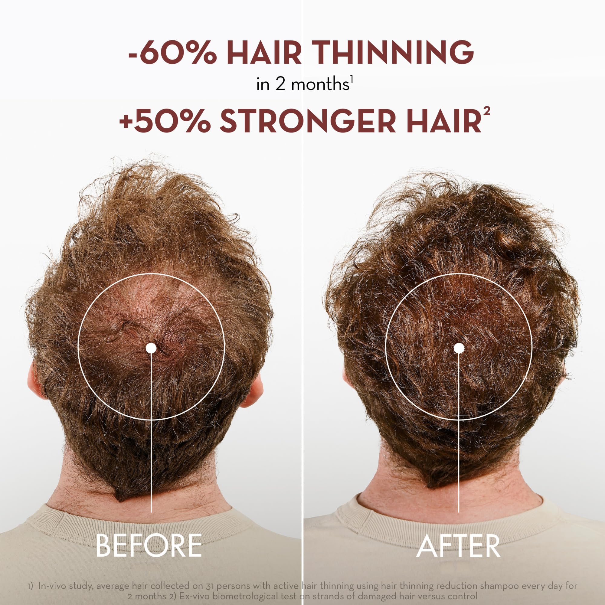 Shampoo foam close-up – smooth cleansing for thinning hair