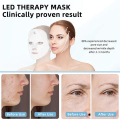 KNNKNN yellow LED mask to brighten and even skin tone at home