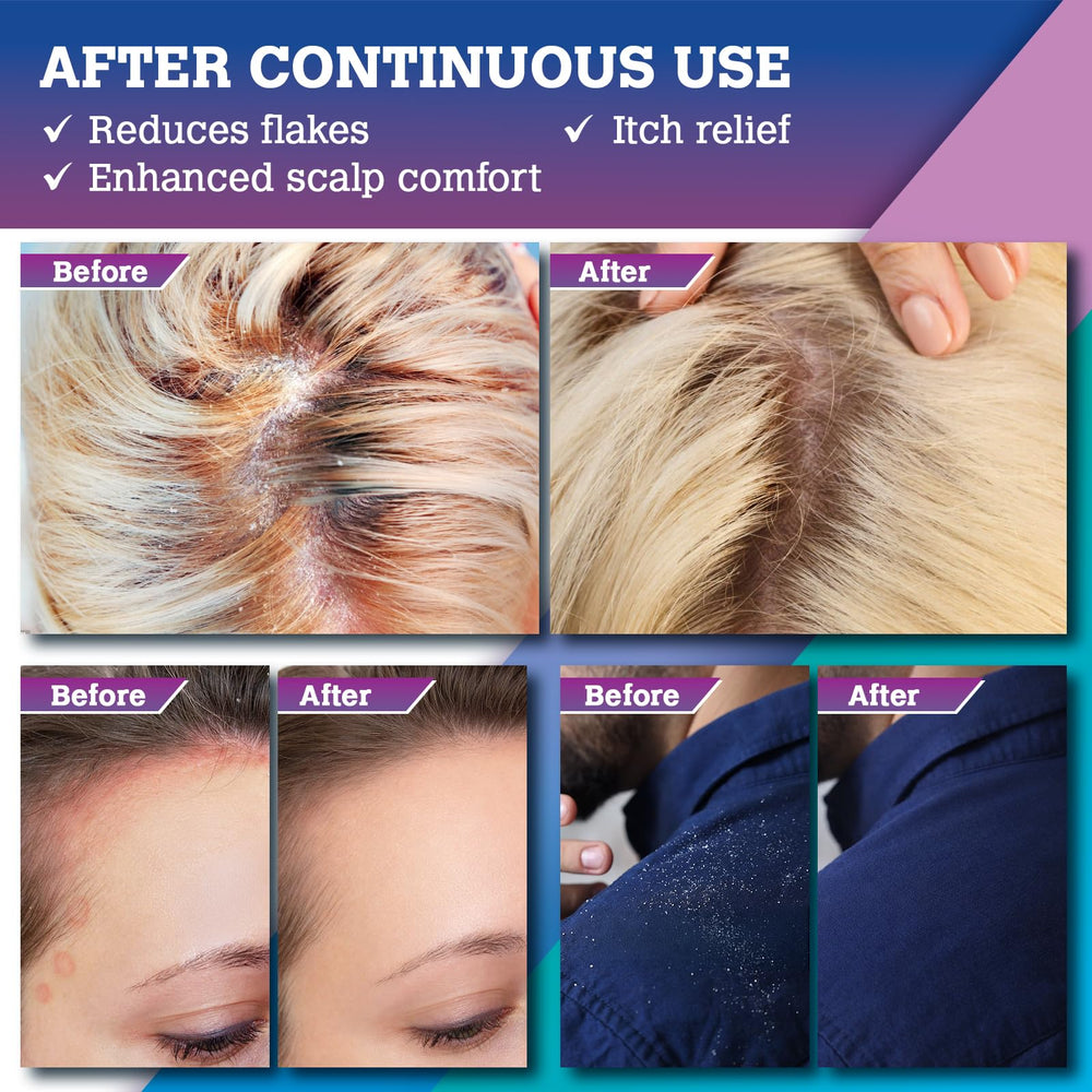 KOPA HAIKU rice water detail suggesting balanced, revitalized scalp.