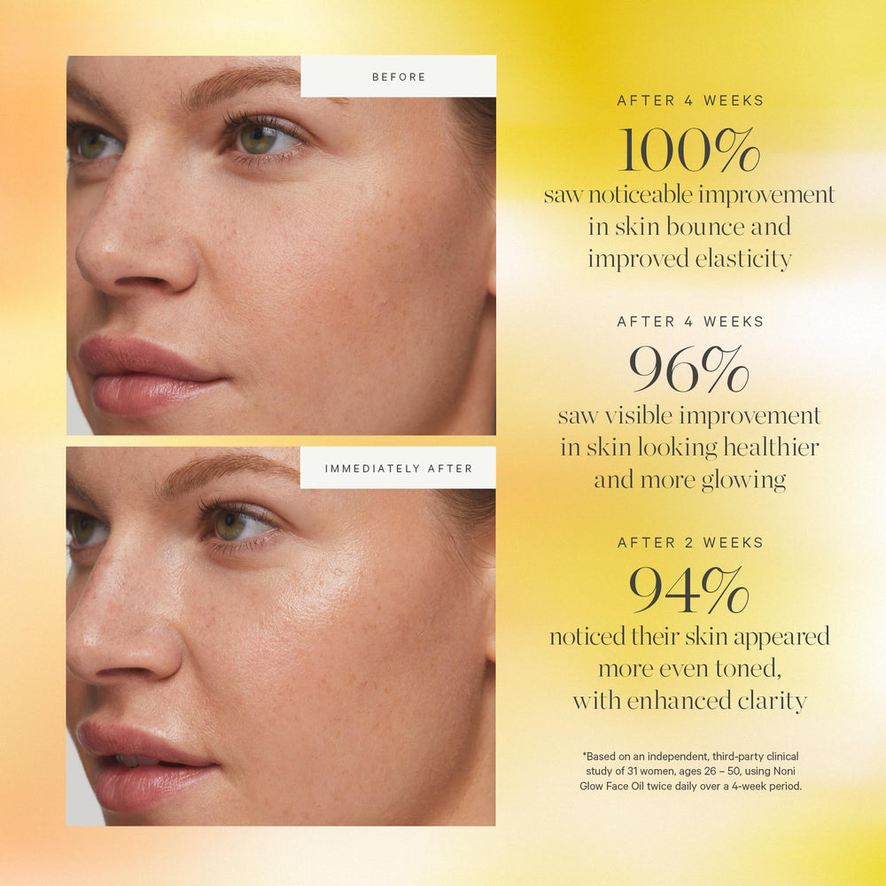 Noni Glow Face Oil features noni extract for antioxidant-rich skincare.