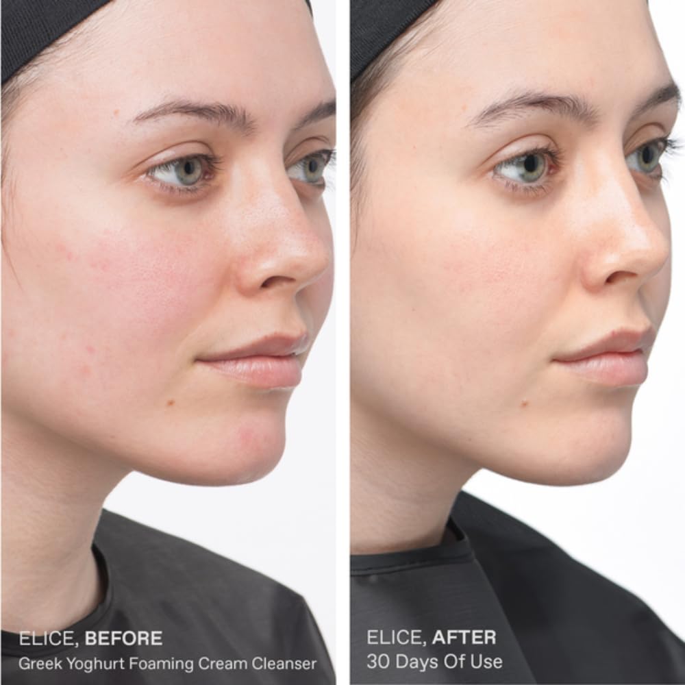 Rinsed skin looks refreshed and hydrated after using the cleanser.