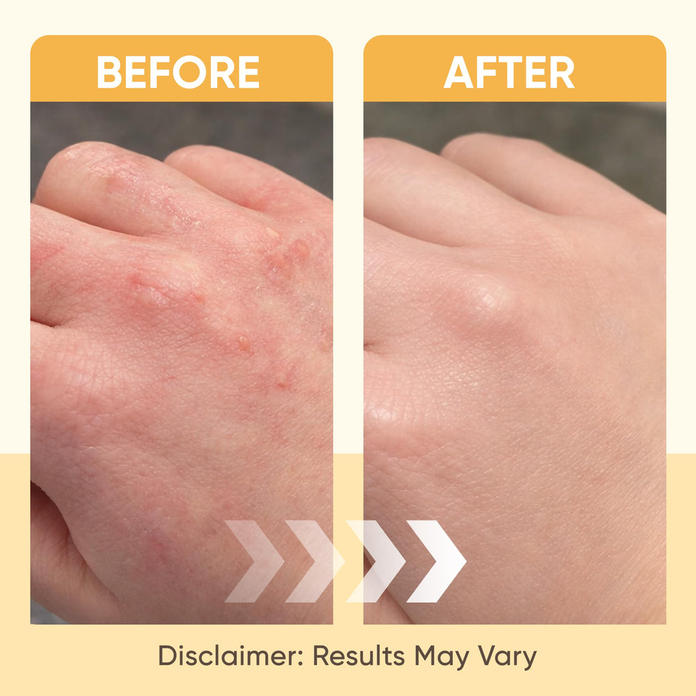KOVGOCY Beezema colloidal oatmeal for soothing skin hydration