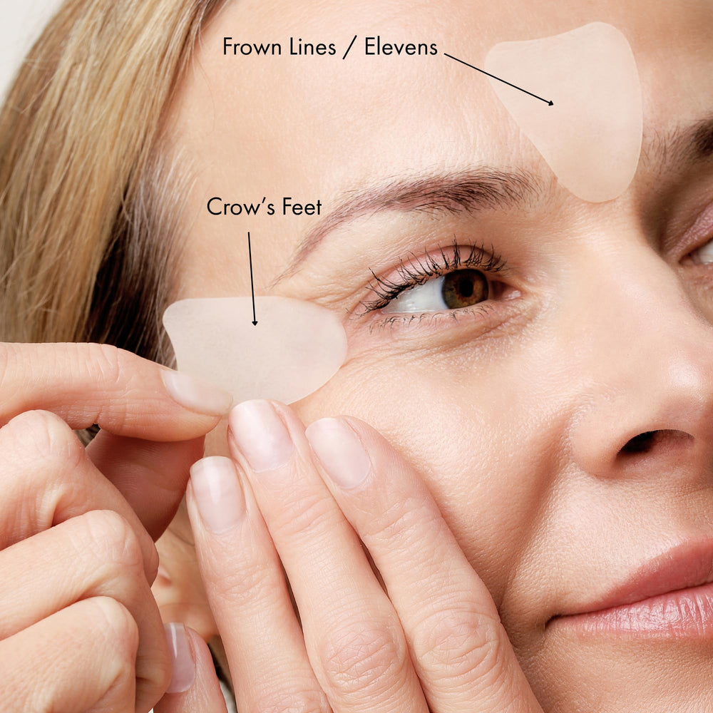 KPLUS patches around crow’s feet reduce visible lines overnight