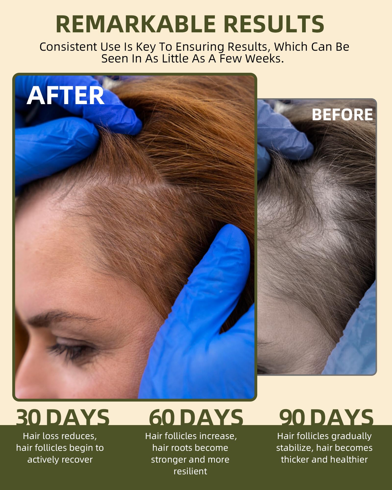 Ktintar Batana promueve crecimiento del cabello y densidad visible.