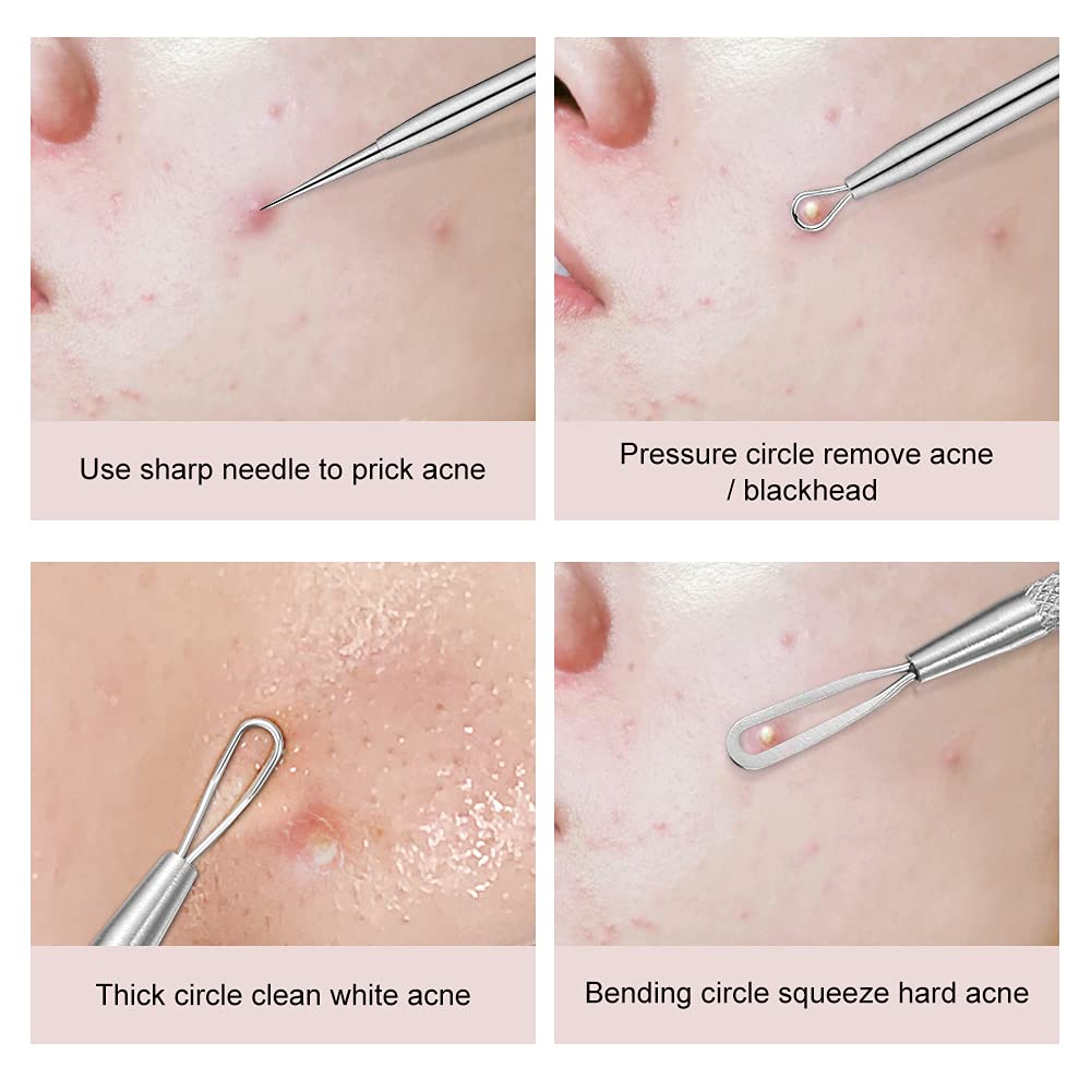 La Chat pimple extractor 2in1 for versatile blemish removal options.