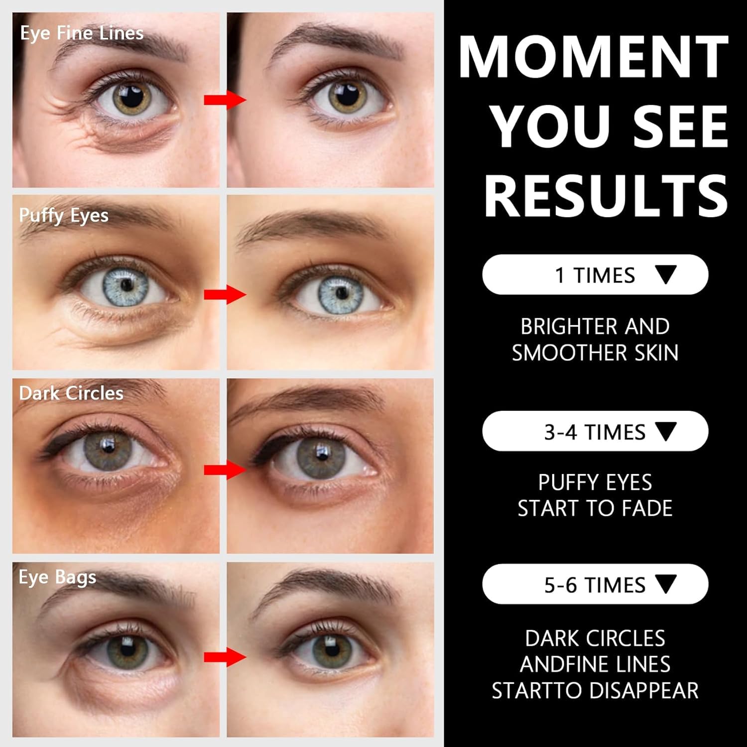 LA MIURA parches ojos antienvejecimiento para una mirada más revitalizada.