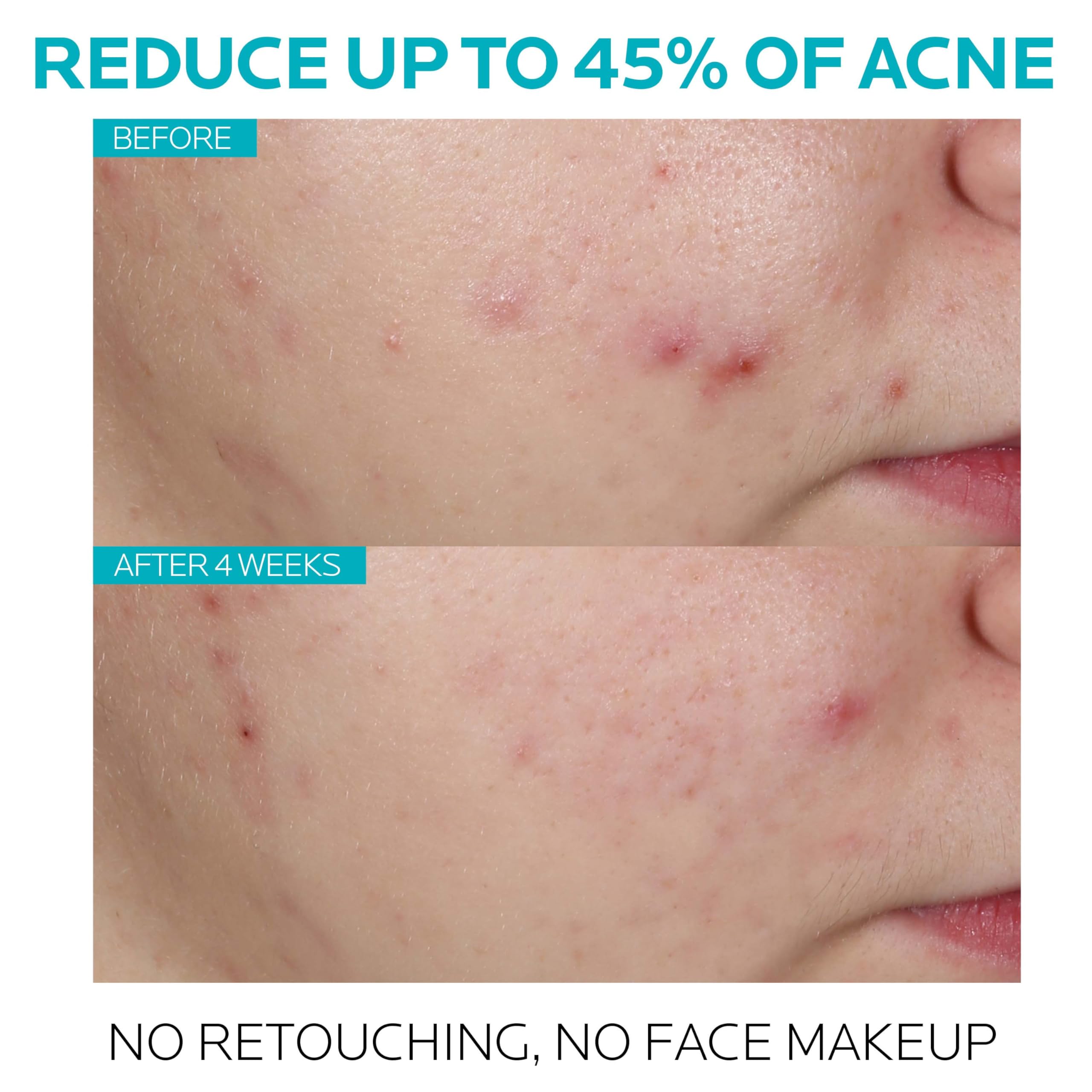 Effaclar Serum drops image demonstrates easy, measured dosing for nightly use.