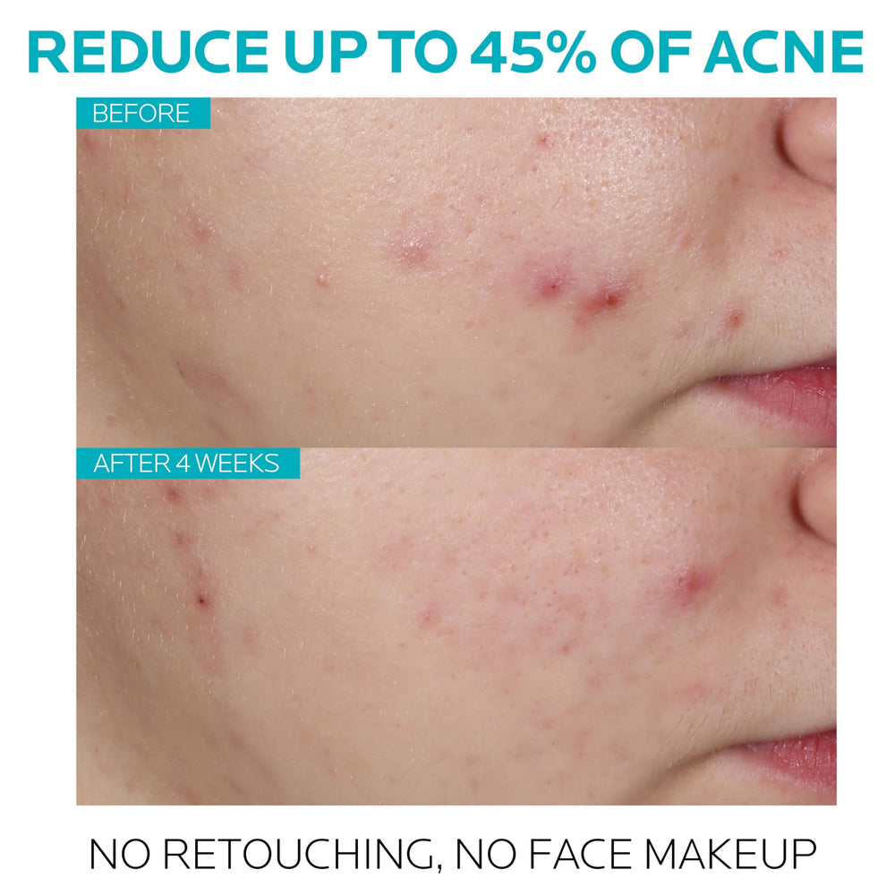 Effaclar Serum drops image demonstrates easy, measured dosing for nightly use.