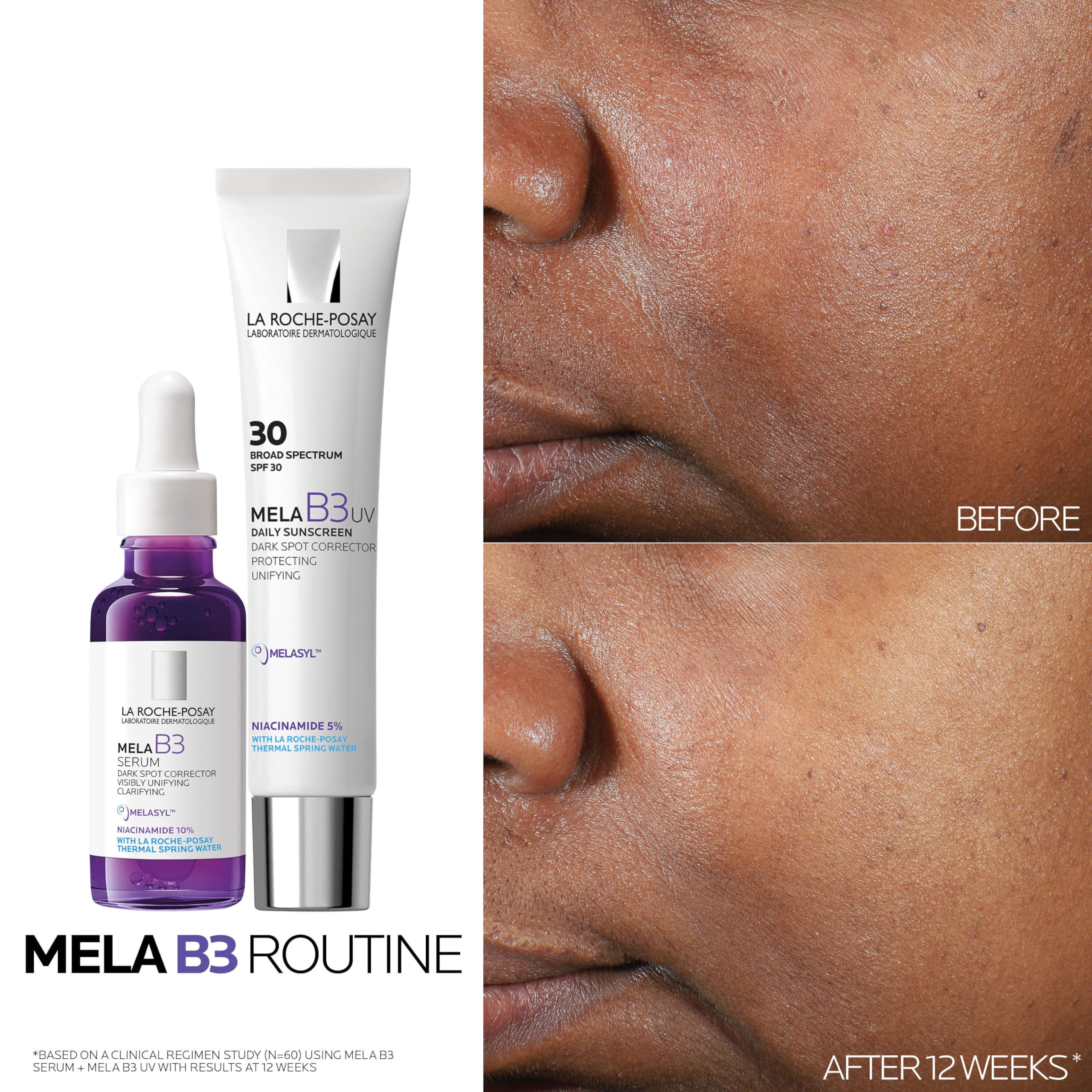 Spot discoloration focus suggesting potential for even-toned skin.