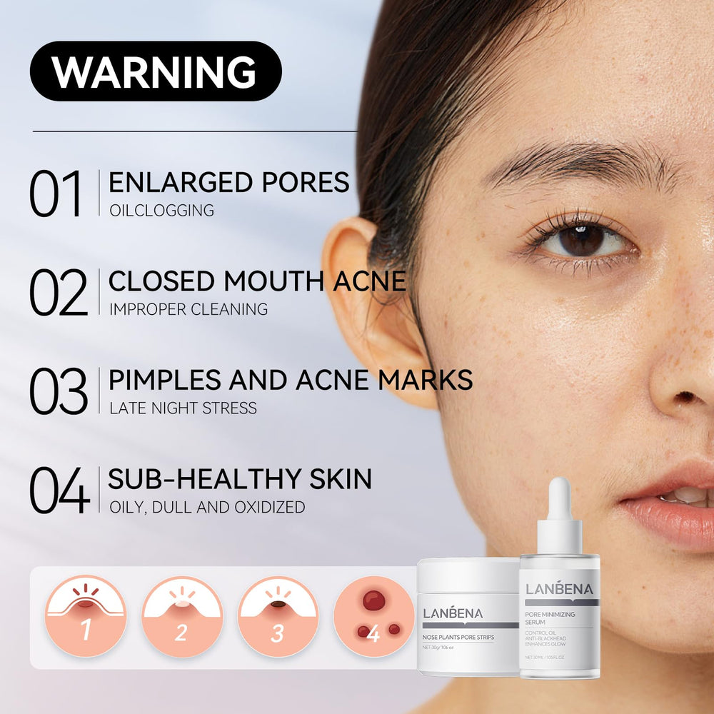 LANBENA removal papers pack for gentle blackhead removal.