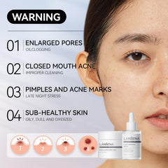 LANBENA removal papers pack for gentle blackhead removal.
