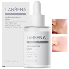 LANBENA Minimizador de poros en bote de 30 ml para reducir poros y control de grasa.