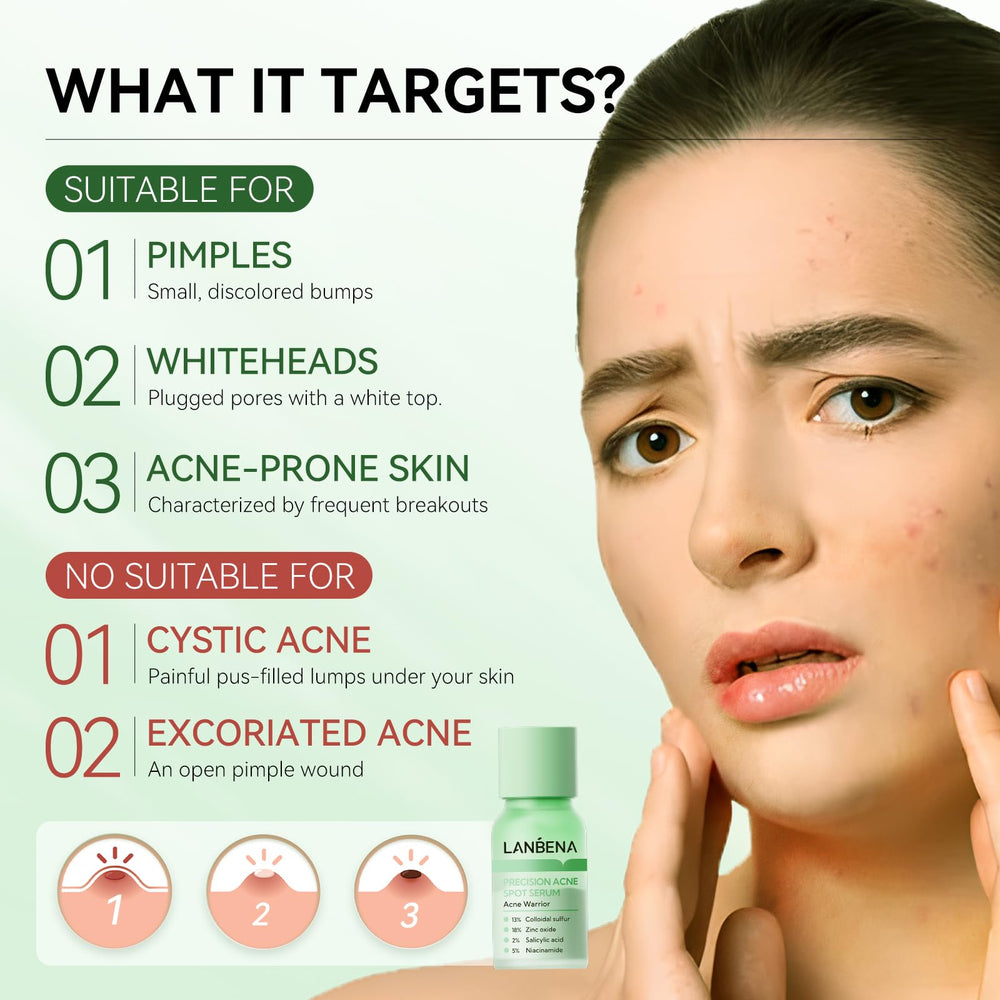 LANBENA tratamiento nocturno para acné: reduce tamaño de granos sin irritar
