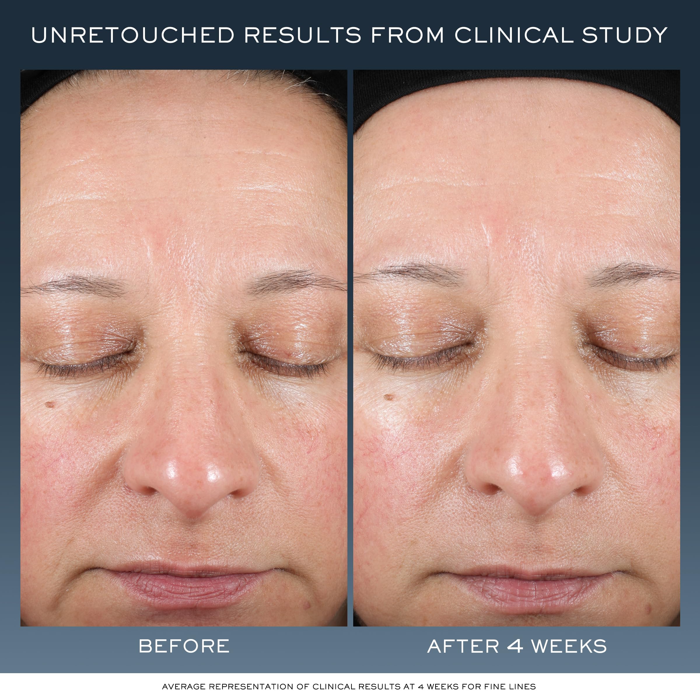 Lancôme Advanced Génifique Night Cream texture showing rich, fast-melting hydration.