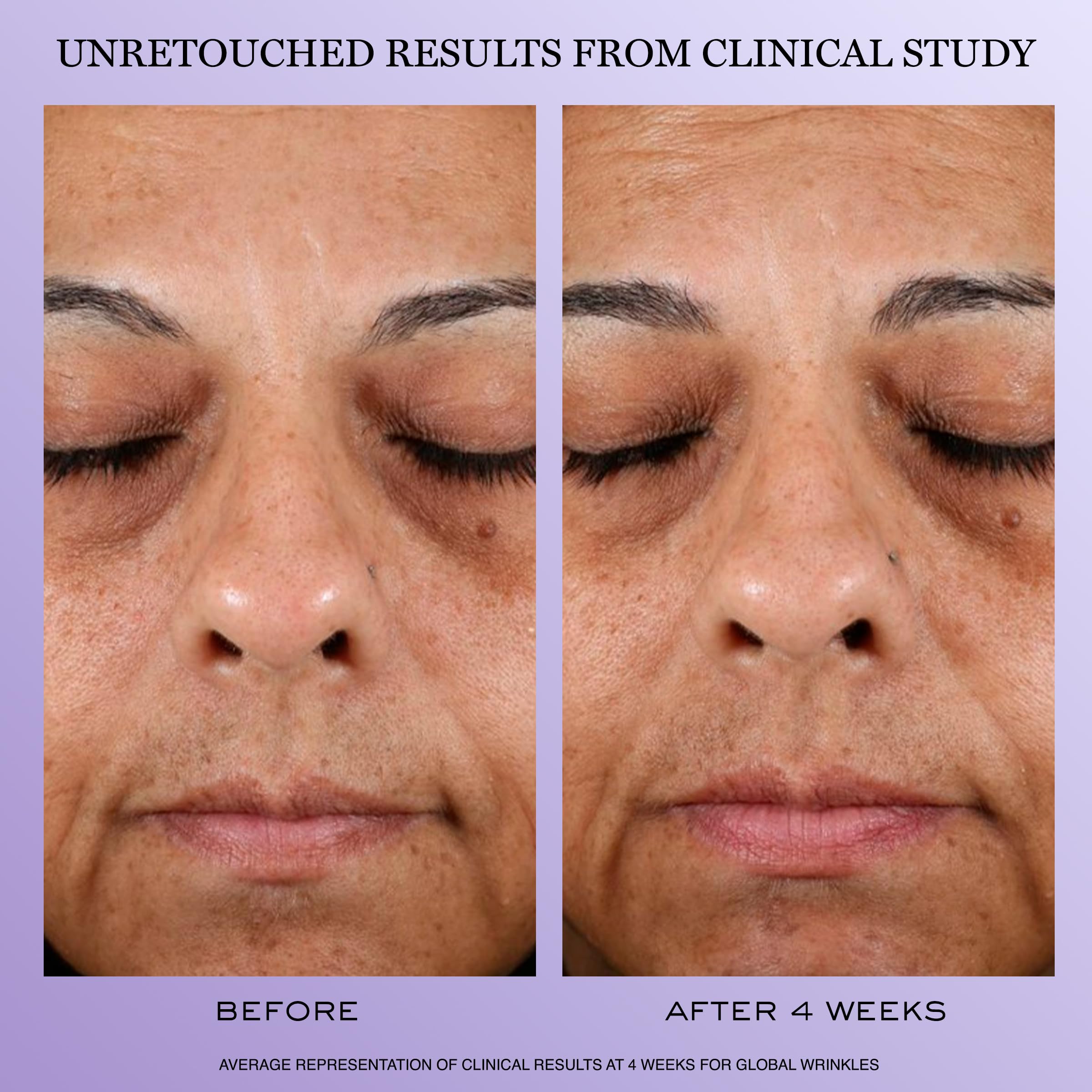 Lancôme Rénergie H.P.N. bottle highlights hyaluronic acid hydration effect.
