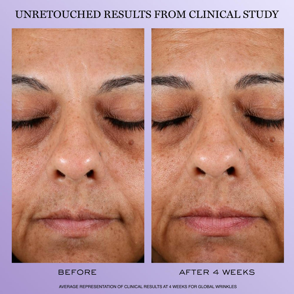 Lancôme Rénergie H.P.N. bottle highlights hyaluronic acid hydration effect.
